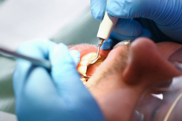 Best Emergency Broken Tooth Repair in Mcminnville, TN