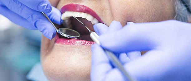 Best Emergency Root Canal Treatment in Mcminnville, TN
